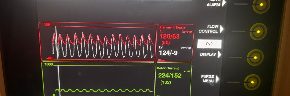 Did you make it through the night okay 