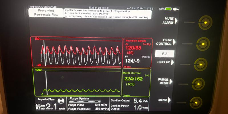 Did you make it through the night okay 